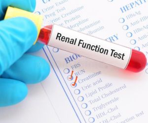 RENAL PROFILE(M/F)